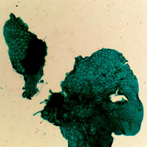 [PR-035] Gástrula de rana