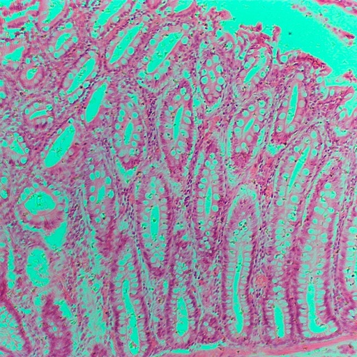 [PR-A26] Intestino grueso (recto) perro