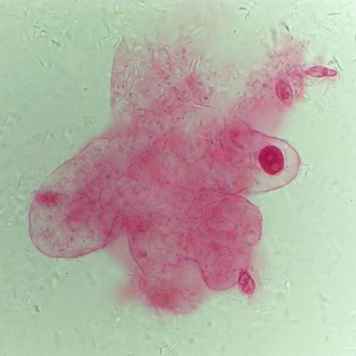 [PR-M01] Preparación microscópica de amiba