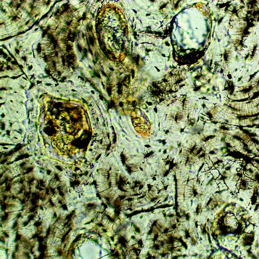 [PR-M10] Preparación microscópica de hueso denso, con cavidades y canales