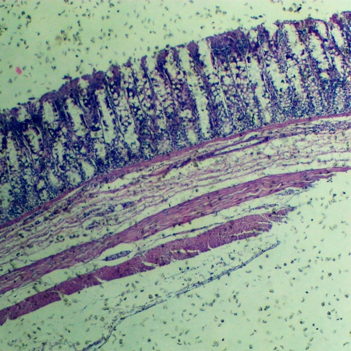 [PR-M16] Preparación microscópica de moho rhizopus