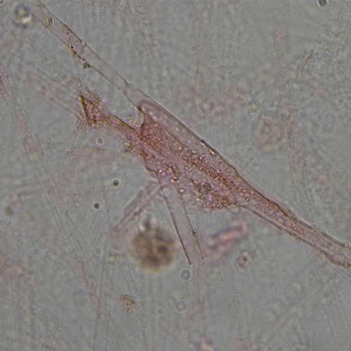 [PR-M32] Colon con células mucosas resaltadas