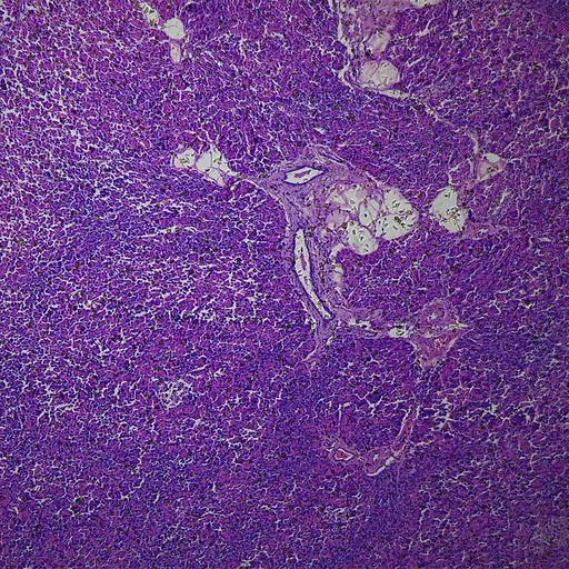 [PR-M33] Preparación microscópica de páncreas con isletas puerco