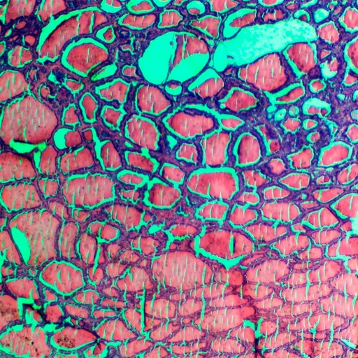 [PR-M34] Preparación microscópica de glángula de tiroide de puerco