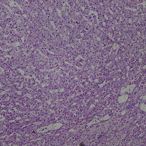 [PR-M35] Preparación microscópica de glándula suprarenal de mamífero