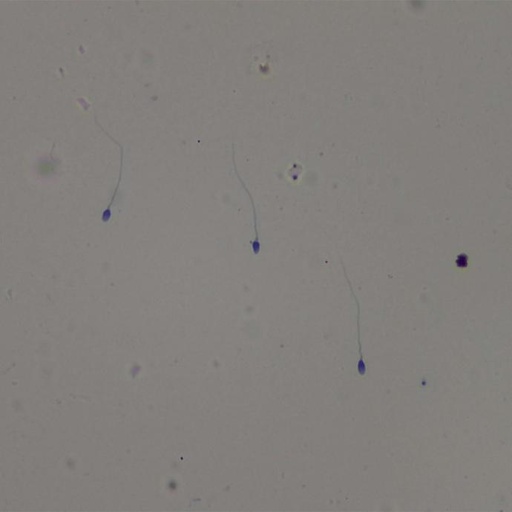 [PR-M36] Preparación microscópica de semen de toro