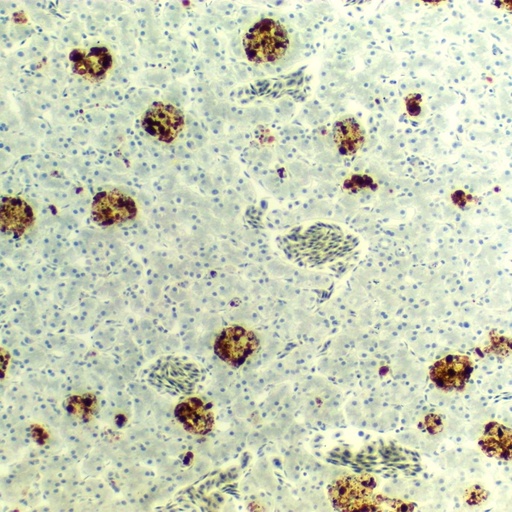[PR-M45] Preparación microscópica de mitocondria