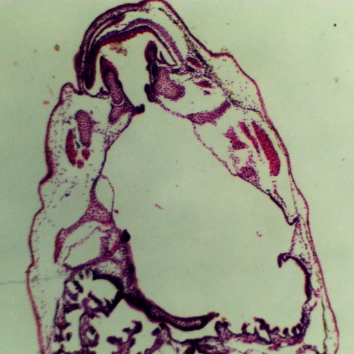 [PR-M67] Preparación microscópica de renacuajo