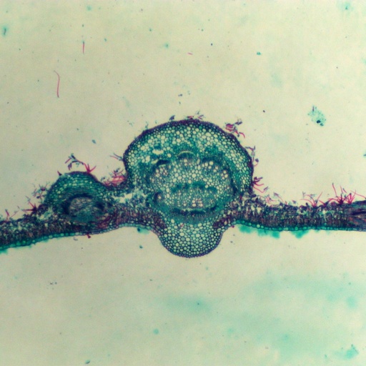 [PR-M69] Preparación microscópica de hoja sana y dañada por lluvia ácida