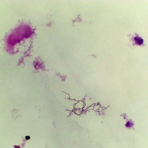 [PR-M70] Preparación microscópica de bacteria de agua (Effluent)