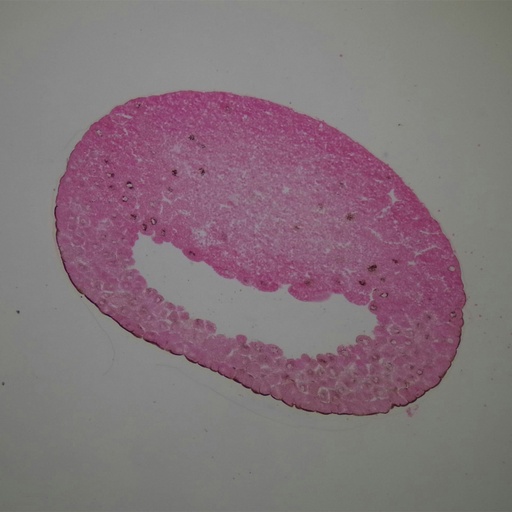 [PR-M72] Preparación microscópica de blástula