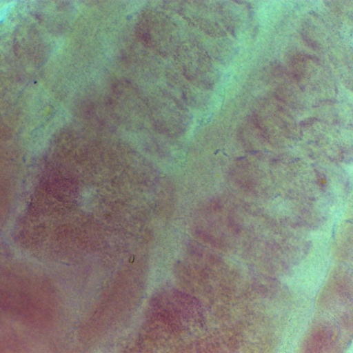 [PR-095] Preparación microscópica de taenia solium madura