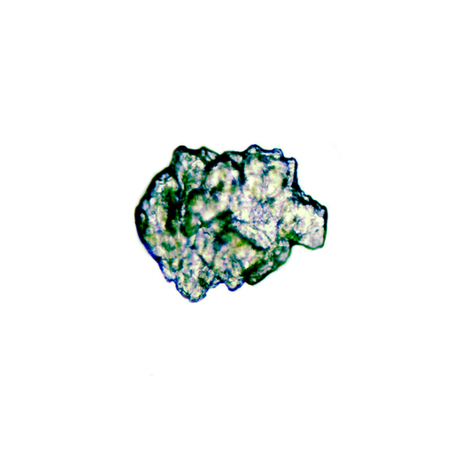 [PR-084] Huevos de schistosoma japonicum