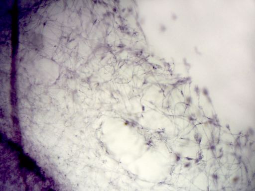 [PR-010] Preparación microscópica de penicilina