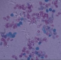 [PR-014] Preparación microscópica de levadura de cerveza (saccharomyces cerevisiae)