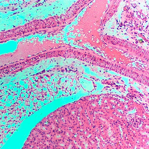 [PR-164] Preparación microscópica de tejido de riñón