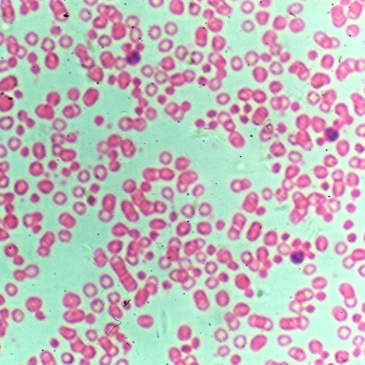 [PR-048] Preparación microscópica de muestra de sangre