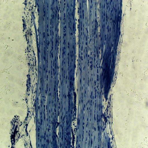 [PR-049] Preparación microscópica de músculo esquelético