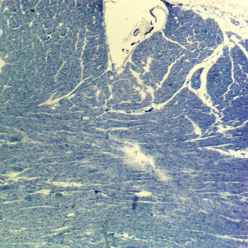 [PR-051] Preparación microscópica de músculo cardiaco