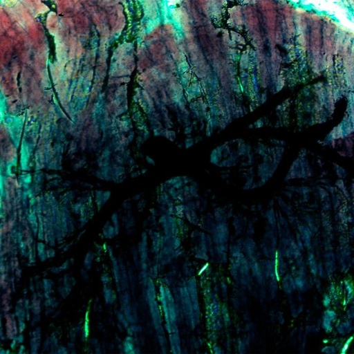 [PR-054] Sinapsis nerviosa