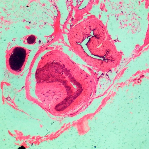 [PR-057] Preparación microscópica de vena y arteria