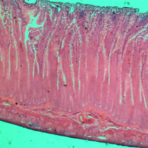 [PR-058] Intestino delgado