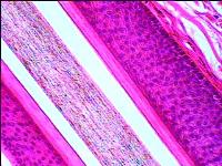 [PR-104] Preparación microscópica de folículo de cabello