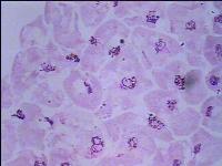 [PR-023] Preparación microscópica de glándula salival de mosca de fruta (drosophila)