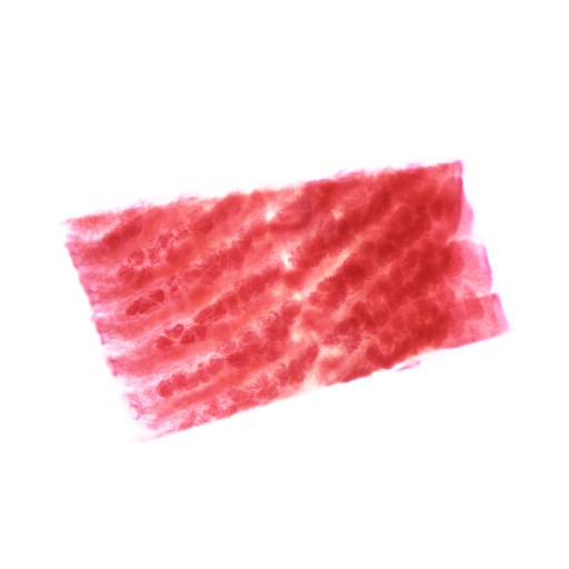 [PR-081] Taenia solium madura cistisercosis