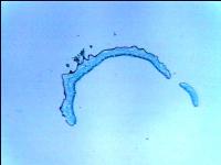 [PR-103] Preparación microscópica de liquenes