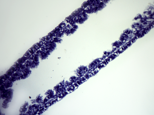 [PR-016] Preparación microscópica de hydra