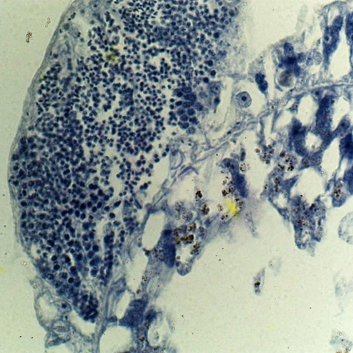 [PR-075] Preparación microscópica de testículos de hydra