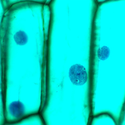 [PR-134] Preparación microscópica de piel de cebolla