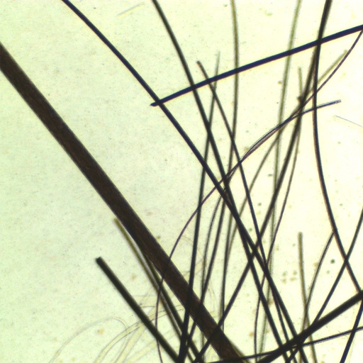 [PR-Q08] Comparativo de cabello humano, pelo de gato y borrego