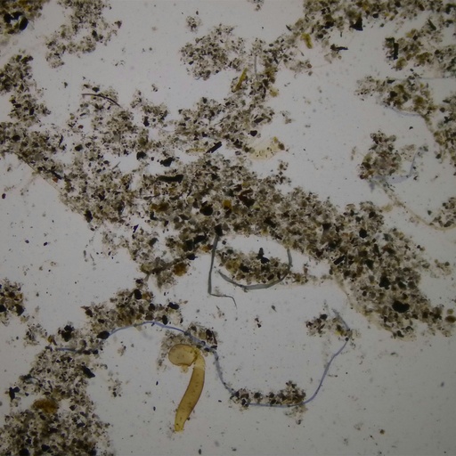 [PR-Q10] Preparación microscópica de polvo