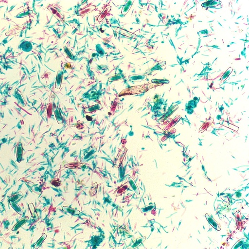 [PR-Q12] Preparación microscópica de diatomeas (algas unicelulares)