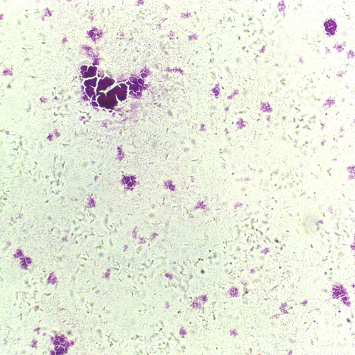 [PR-Q15] Preparación microscópica de escherichia coli