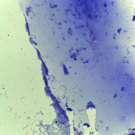[PR-Q17] Preparación microscópica de bacillus anthracis bacteria gram +