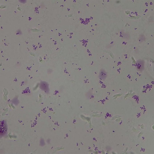 [PR-Q18] Bacillus gram -