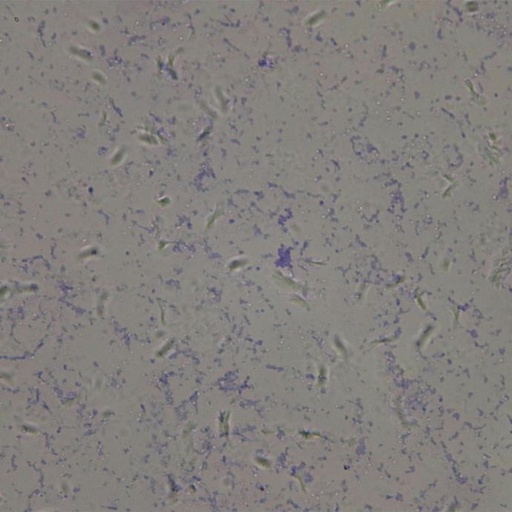 [PR-Q21] Preparación microscópica de tétanos