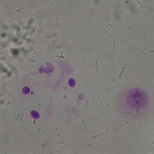 [PR-Q23] Preparación microscópica de cromosoma XY (macho)