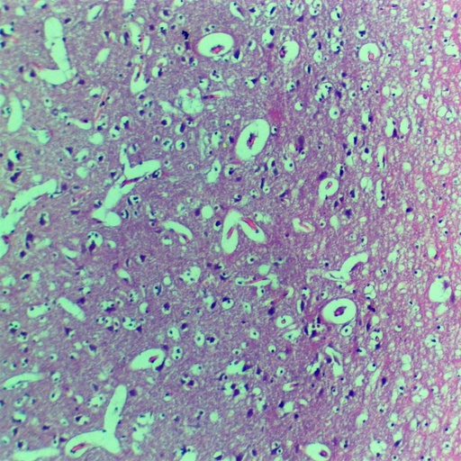 [PR-M39] Preparación microscópica de cerebelo con células piramidales