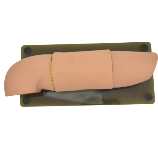 [BRA-CON] Brazo para colocación y remoción de material anticonceptivo