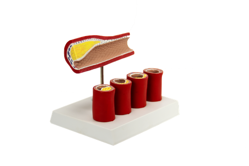 [TROMBO] Modelo de trombo