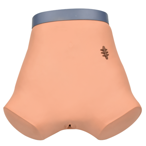 [CAT-AB] Caterización y punción abdominal