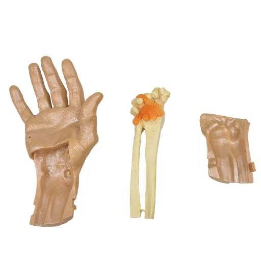 [MAN-ART] Simulador para realizar artroscopia de mano