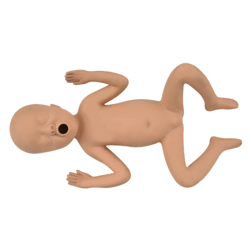 [PREM-24] Recien nacido prematuro 24 semanas