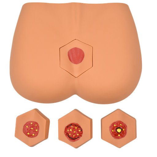[SIM-UL] Simulador para el cudado de la ulcera/ etapa decubito