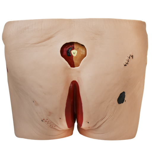 [ULCERA-CUIDADO] Simulador de cuidados de úlcera de decúbito