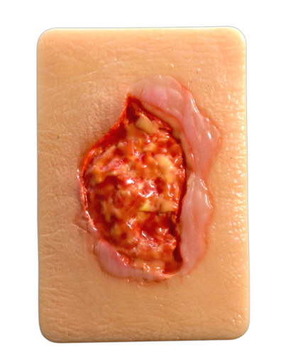 [TEJ-GRANULADO-CRONICO] Simulador de tejido con hipergranulación (copia)